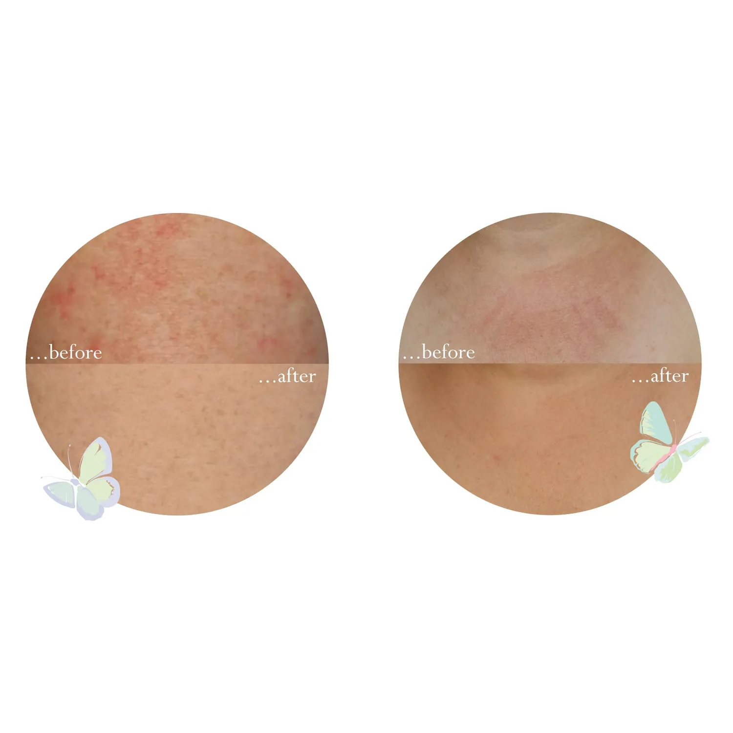 Little Butterfly Dewdrops at Dawn latte corpo 100ml bio