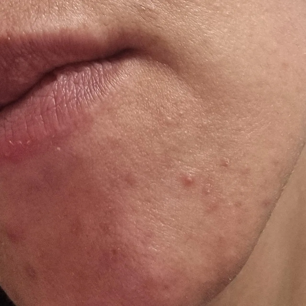 Uriage Xemose detergente viso e corpo pelli atopiche