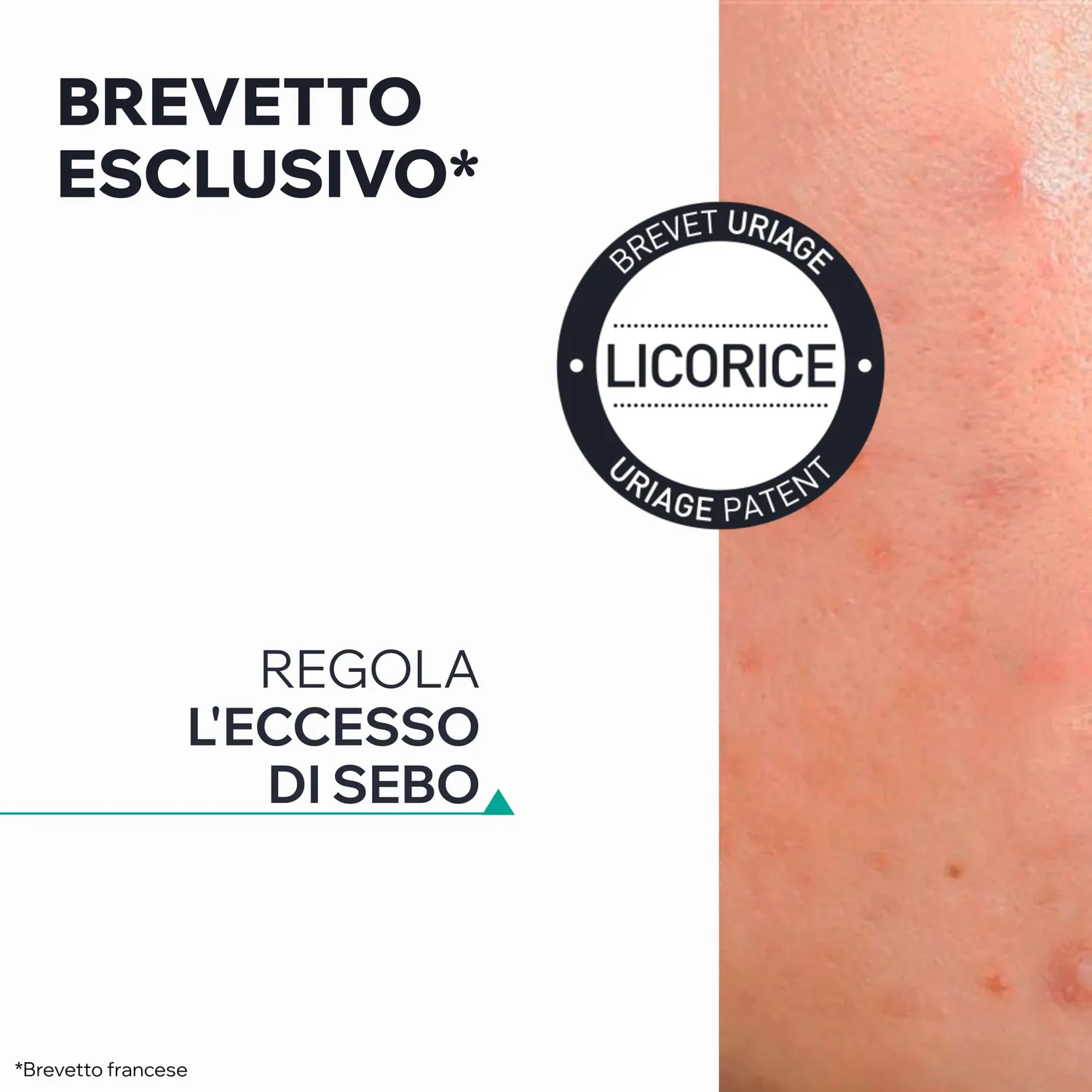 Uriage Hyseac Gel SOS Purificante brufoli AHA BHA