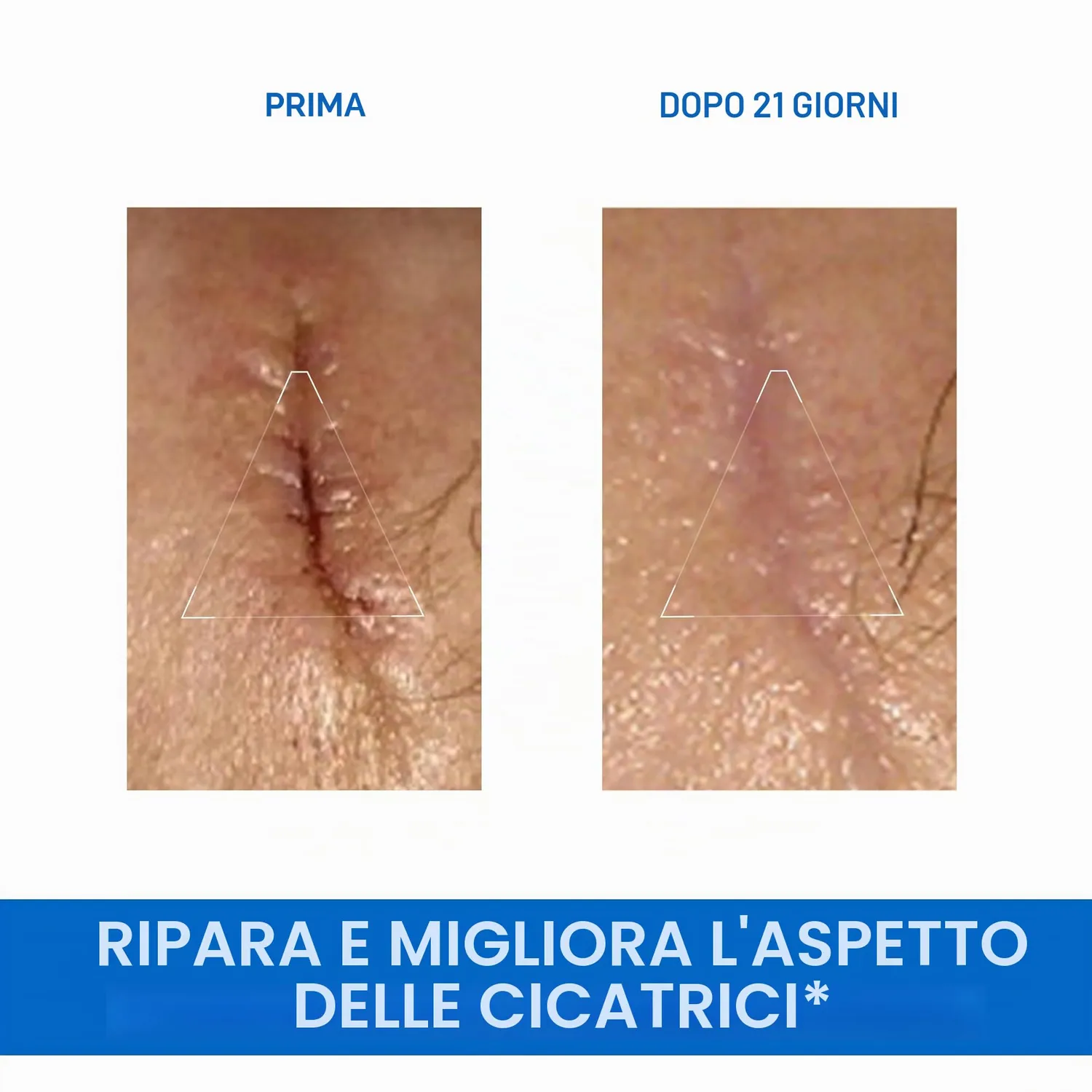 Uriage Bariéderm-Cica cica-crema 40 ml purificante