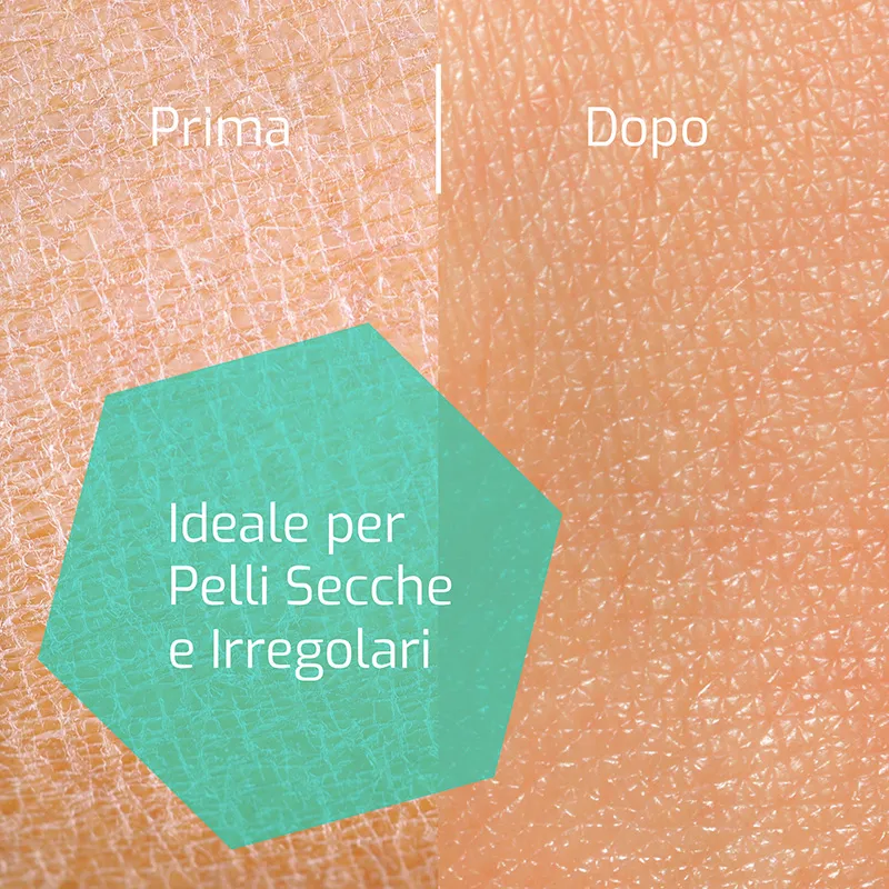Omeovita CeraLab Crema Levigante corpo urea 10% esfoliante